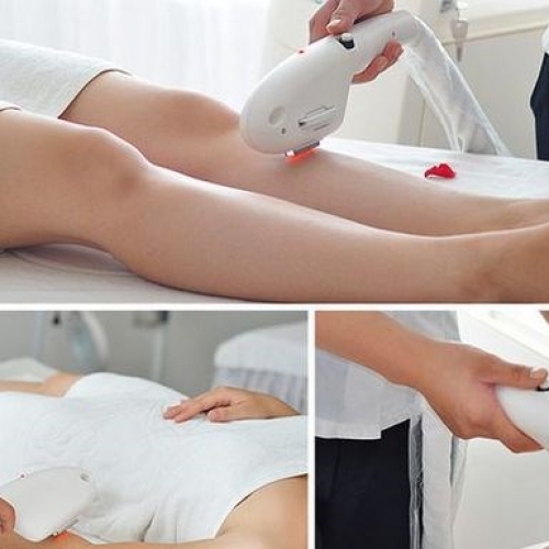 Lưu ý trước khi triệt lông vĩnh viễn tại Đà Nẵng