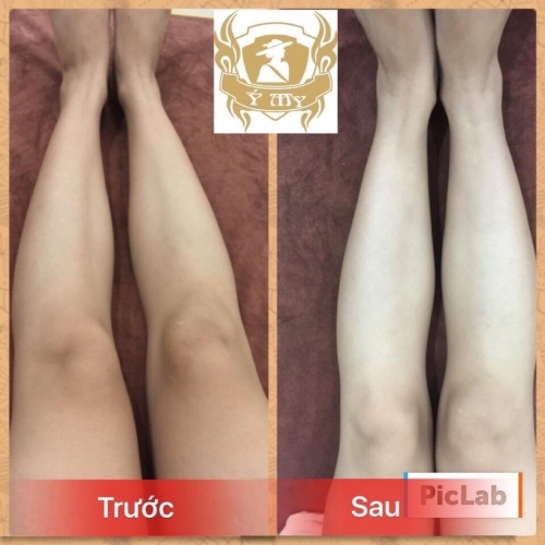 Quy trình tắm trắng tại Đà Nẵng chuyên nghiệp