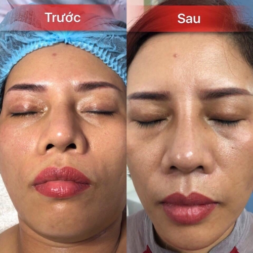Thanh Nga ở Thanh Hoá