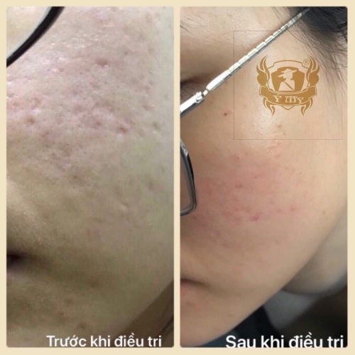 Ánh Nhật - nhân viên Khách sạn
