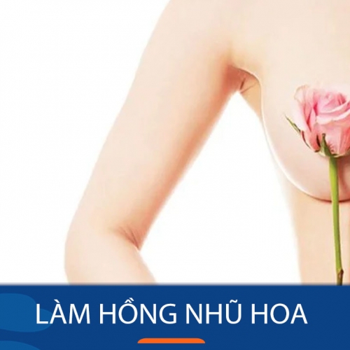 Những điều cần lưu ý khi làm hồng nhũ hoa tại Đà Nẵng
