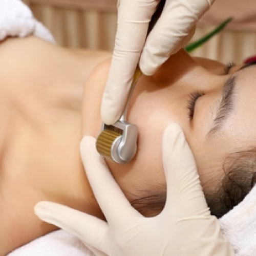 Phương pháp lăn kim là gì? Những điều cần biết về lăn kim tại Đà Nẵng