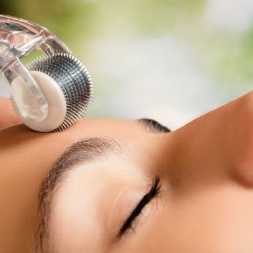 Tại sao cần lựa chọn dịch vụ lăn kim?