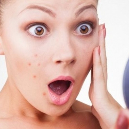 Hiểu về điều trị mụn trứng cá tại Đà Nẵng