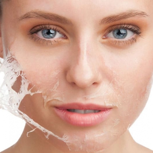 Quy trình điều trị mụn tái tạo da sinh học tại Đà Nẵng